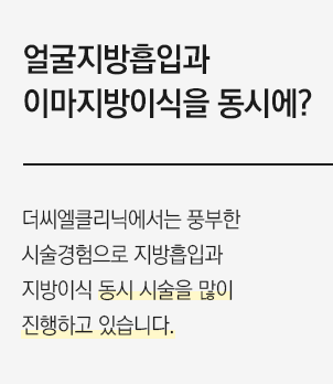 얼굴지방흡입