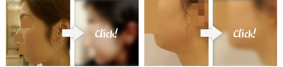 리얼후기