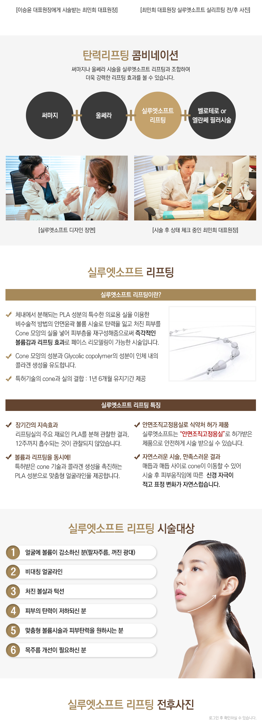 실루엣리프팅