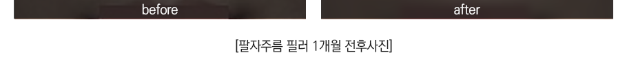 필러/엘란쎄