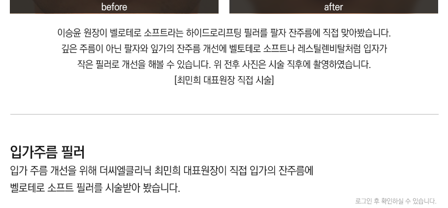 필러/엘란쎄
