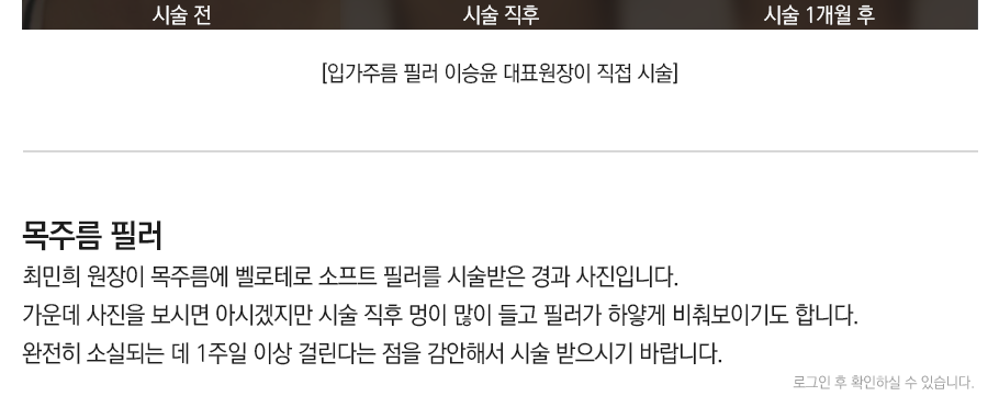 필러/엘란쎄