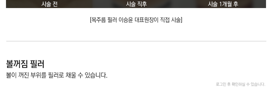필러/엘란쎄