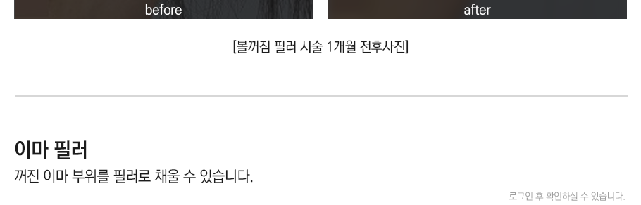 필러/엘란쎄