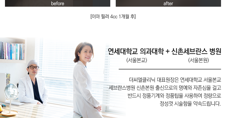 필러/엘란쎄