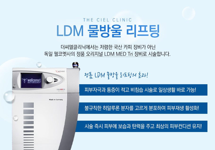 LDM
