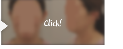 실루엣리프팅