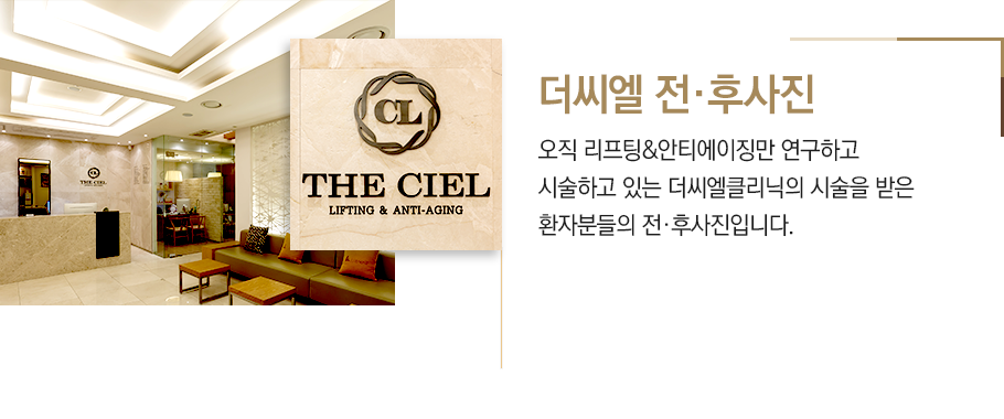 전후사진